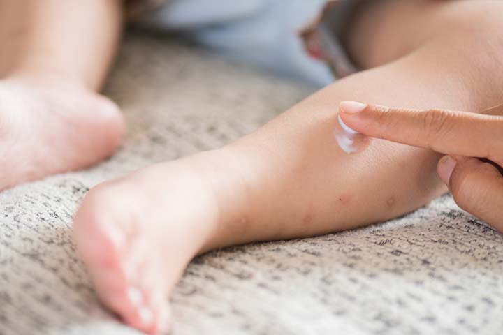 Calamine Lotion for Babies Uses, Safety And Side Effects